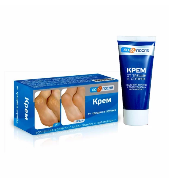 Kem làm mềm và giảm nứt nẻ gót chân Kpem Nga 50ml